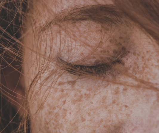 How to Support Your Skin’s Microbiome Naturally