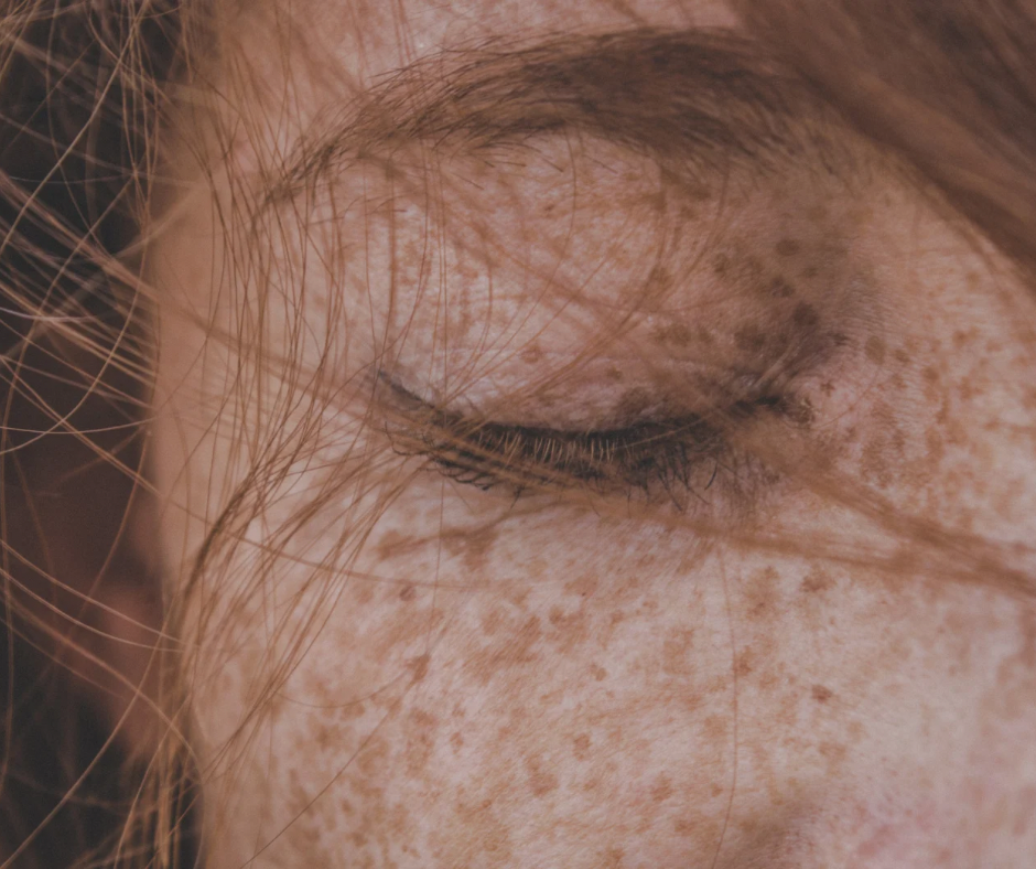 How to Support Your Skin’s Microbiome Naturally